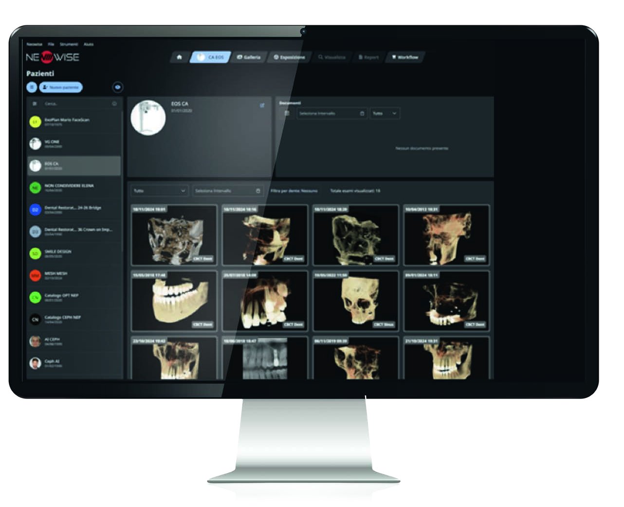 NeoWise imaging software for Castellini EOS Compact